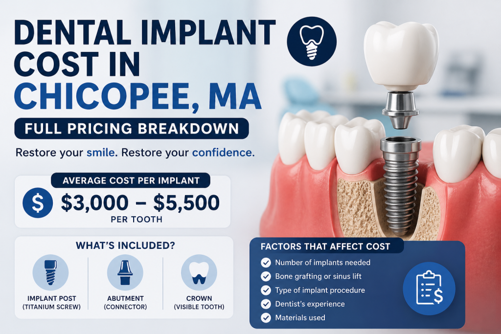 Dental implant costs in Chicopee, MA